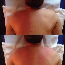 effetti massaggio spalla